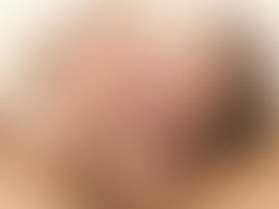 Povd thumb